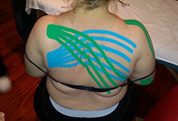 Linfotaping